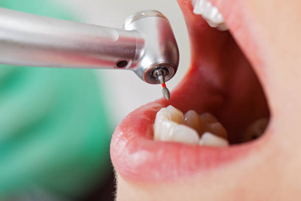 Best Emergency Root Canal Therapy in Mckees Rocks, PA